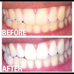 AP24 Whitening Toothpaste MAGIC ! 2 Pack